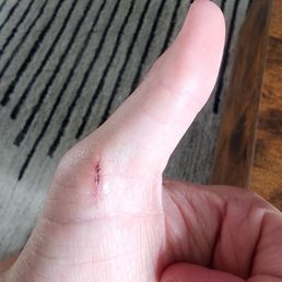 You know it's a sharp knife when it didn't even hurt You know it's a sharp knife when it didn't even hurt