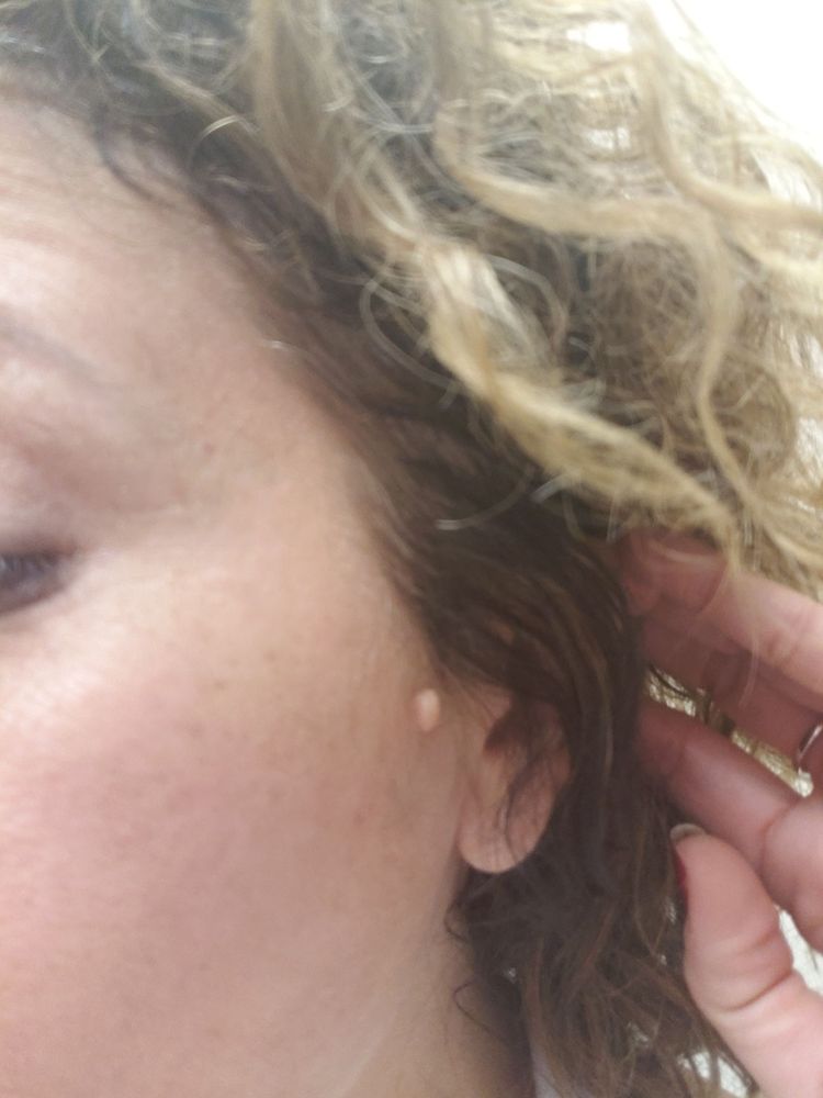 ATLANTA CENTER FOR DERMATOLOGIC DISEASES - Updated August 2024 - 11
