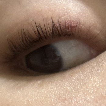 Eye Tactics Lash Lift Studio - I got chemical burns on my eyes and when I said it was burning and asked if I could take it off I was told that was not an option. - Eyelash Service Near Me - Las Vegas, Nevada Eye Tactics Lash Lift Studio - I got chemical burns on my eyes and when I said it was burning and asked if I could take it off I was told that was not an option. - Eyelash Service Near Me - Las Vegas, Nevada