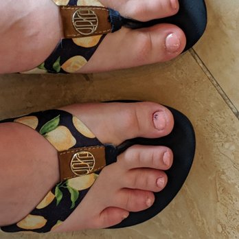 Infinity Nail Spa - Slightly messy pedicure, and my cuticles are still bleeding! - Nail Salons Near Me - Turlock, California