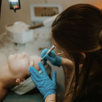 Skottē Esthetics - Microdermabrasion - Skin Care Near Me - Corvallis, Oregon