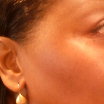 Dabbo Skin Care Studio - Dark spots? Uneven skin tone? No problem. Dabbo can help. No makeup. No retouch. Naked skin! - Skin Care Near Me - Torrance, California Dabbo Skin Care Studio - Dark spots? Uneven skin tone? No problem. Dabbo can help. No makeup. No retouch. Naked skin! - Skin Care Near Me - Torrance, California