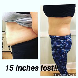 Bella Estetica Spa - Body Sculpting & nutritional coaching