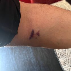 Labcorp - THIS NEVER HAPPENS TO ME! ITS BEEN 3 HOURS AND I AM STILL SORE IN THE AREA WHERE THE BLOOD WAS DRAWN!