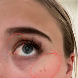 Amazing Lash Studio - You can see one on my face and half are gone on both ends