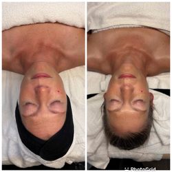 Foreviva Medical Clinique - Customized VivaWell facial