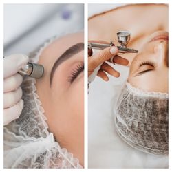 Hanna Wellness Studio - *Microdermabrasion: is one of the most modern methods of skin rejuvenation.