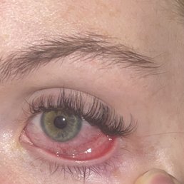 My eye the day after having my lashes done here My eye the day after having my lashes done here
