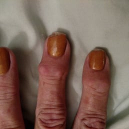Had these done today 2 broken 1 chipped Had these done today 2 broken 1 chipped