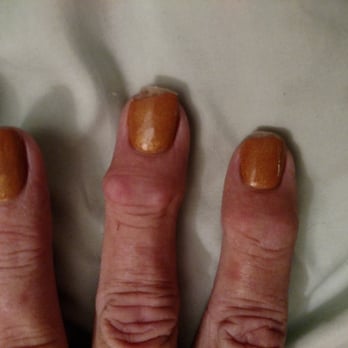 T And L Nails Ii - Had these done today 2 broken 1 chipped - Nail Salons Near Me - Boynton Beach, Florida T And L Nails Ii - Had these done today 2 broken 1 chipped - Nail Salons Near Me - Boynton Beach, Florida