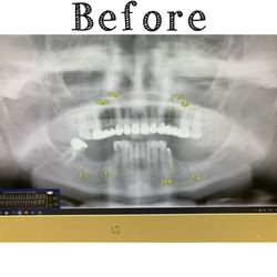 Oakland Family Dental Care