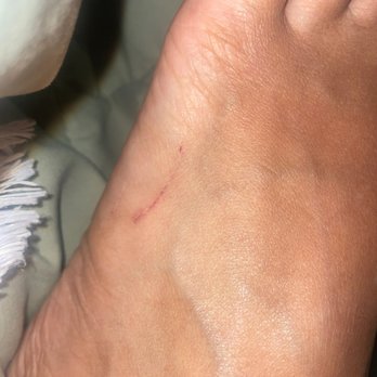 Happy Nails Bar - Scratch on foot one day after incident - Nail Salons Near Me - Washington, DC, District of Columbia Happy Nails Bar - Scratch on foot one day after incident - Nail Salons Near Me - Washington, DC, District of Columbia