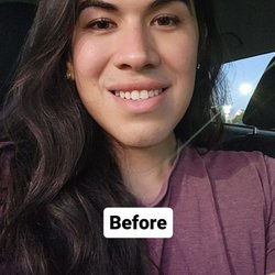 California Cosmetics - Before procedure