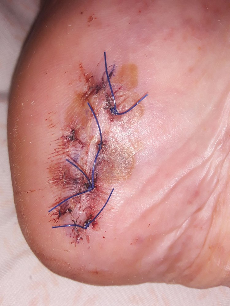 Southwest Foot and Ankle Center