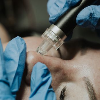 Complexion Esthetician - Estheticians Near Me - Manteca, California