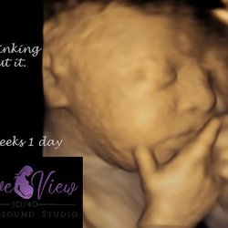 Love View 3d 4d ultrasound studio
