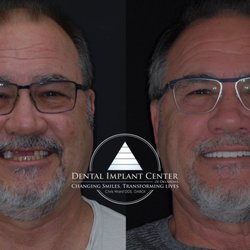 Dental Implant Center of Oklahoma | Chris Ward DDS DABOI