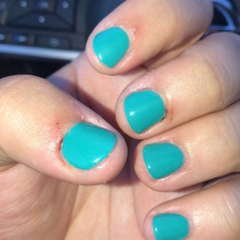 Dazzling Nails And Spa - thumb and middle fingers on this hand are bleeding too - Skin Care Near Me - Rocklin, California