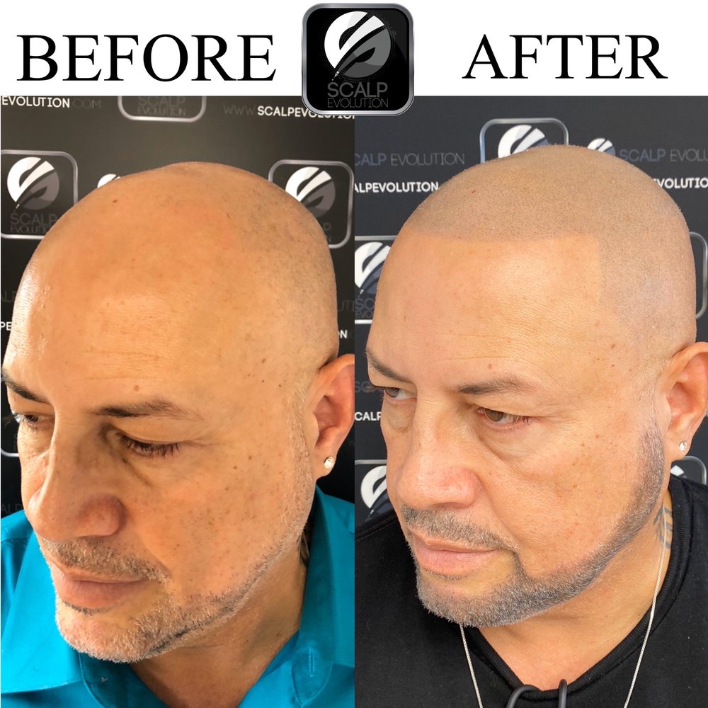 SCALP EVOLUTION 52 Photos 1330 SW 22nd St, Miami, Florida Hair