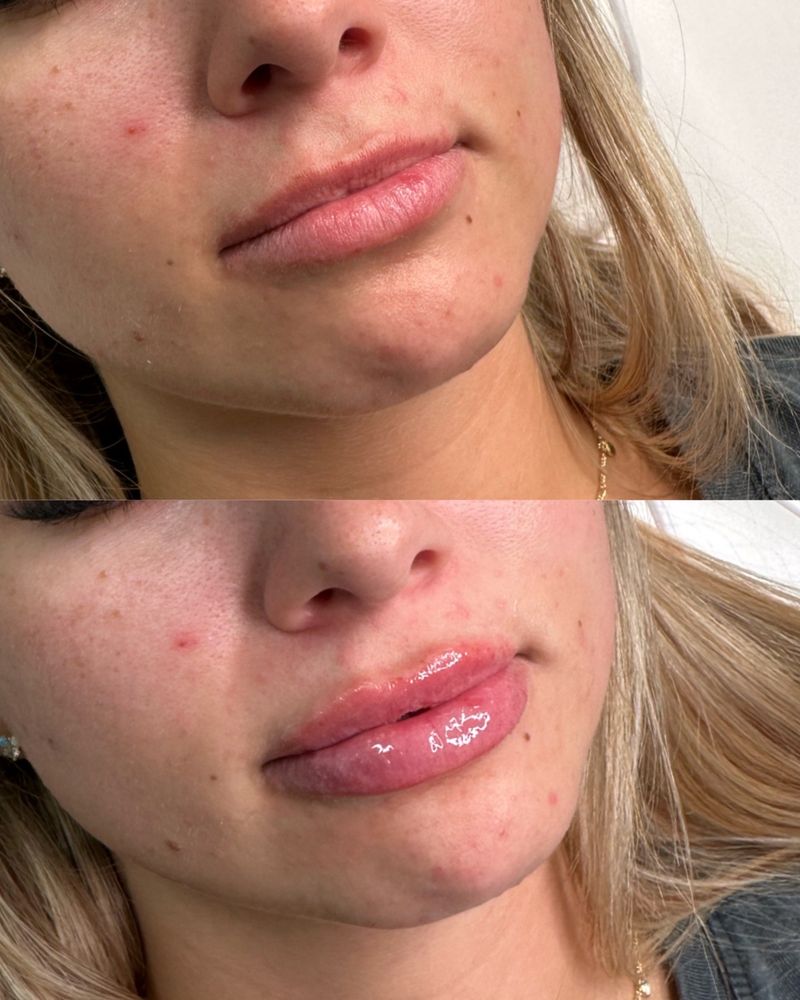 KC Injectables Med Spa Logo