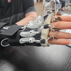 Norman Physical Therapy - Custom Splint