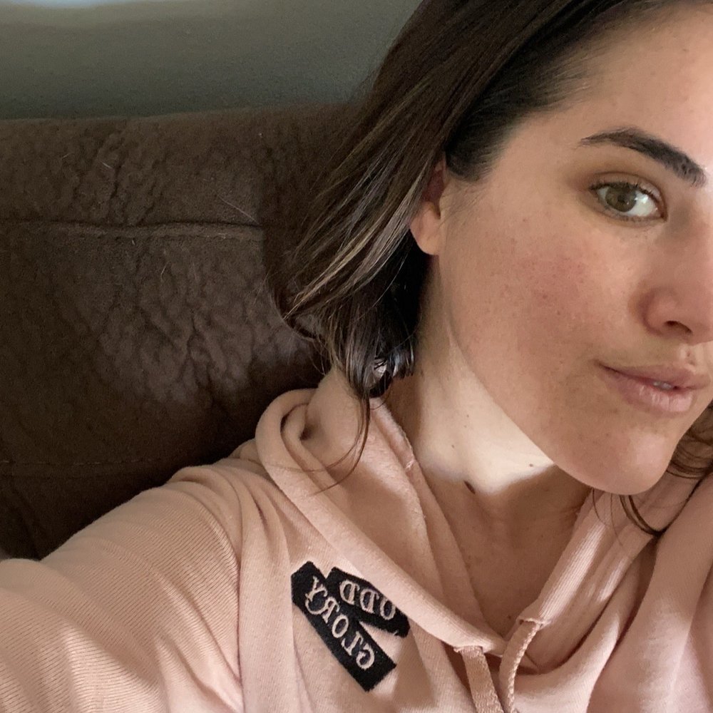 Skin post facial + microdermabrasion!