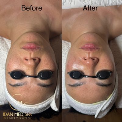 Idan Med Spa by null