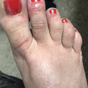 US Nails & Spa - Was a repeat customer and then this happened. Tech took off gel nails with file and tore up my feet. I don't think I can try going back. - Nail Salons Near Me - Fairbanks, Alaska