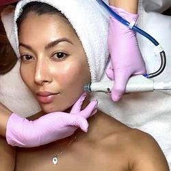 Skin Technology - Hydrafacial