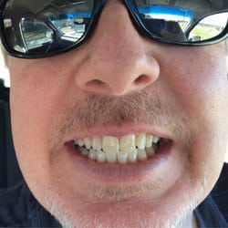 Kevin L Seidler, DDS - They do good work!