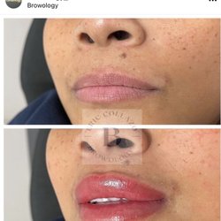 Browology - Lip pigmentation lasting 3-4 years