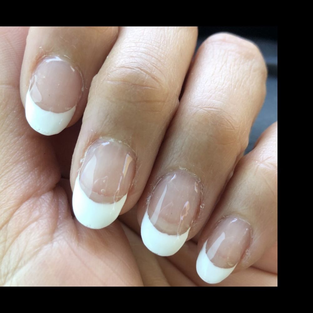 Horrible nails! Horrible nails!