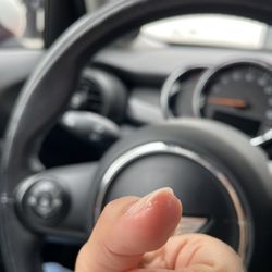 Gel that wasn't properly removed