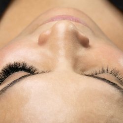 Yegi Beauty - Before and after
