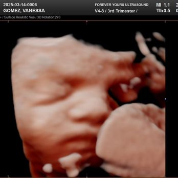 Forever Yours Ultrasound - Ultrasound Imaging Centers Near Me - Fullerton, California