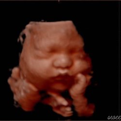 Sweet Pea 4D Baby To Be Imaging - Just look at those cheeks!