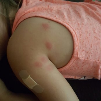 Comfort Suites Oceanside Camp Pendleton Area - BED BUGS! - Hotels Near Me - Oceanside, California Comfort Suites Oceanside Camp Pendleton Area - BED BUGS! - Hotels Near Me - Oceanside, California