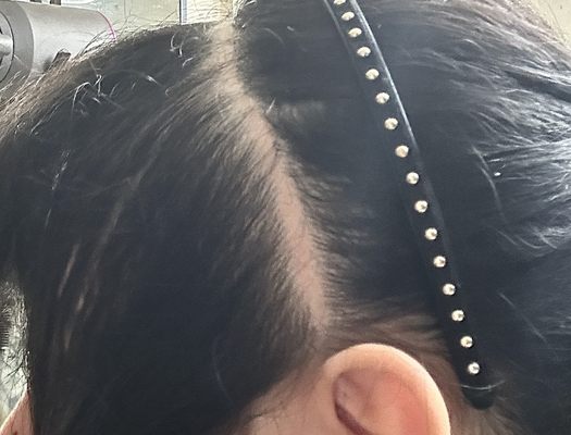 BEVERLY HILLS TRANSGENDER SURGERY: DR. ALEXANDER SINCLAIR - Updated ...