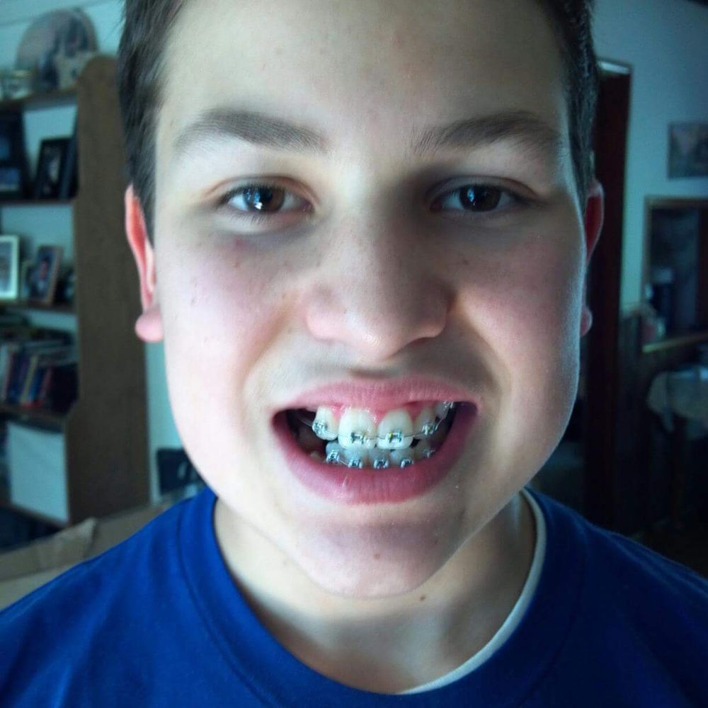 Stephen J Giovanisci, DDS - One Dr. One stop shop for caring for our son's teeth. One office for appts. One team goofing with this kid. Affordable & amazing results! - Orthodontists Near Me - Montrose, California Stephen J Giovanisci, DDS - One Dr. One stop shop for caring for our son's teeth. One office for appts. One team goofing with this kid. Affordable & amazing results! - Orthodontists Near Me - Montrose, California