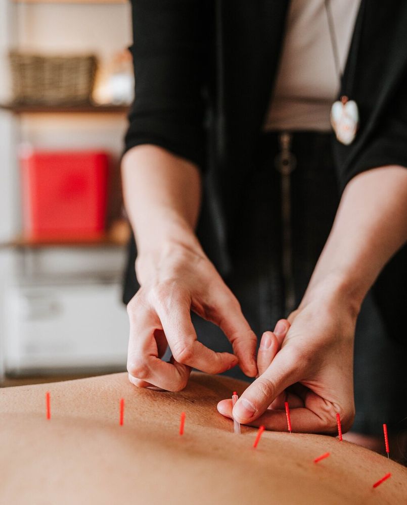 SACRED EARTH ACUPUNCTURE AND HOLISTIC HEALING 30 Photos 2020 Dean