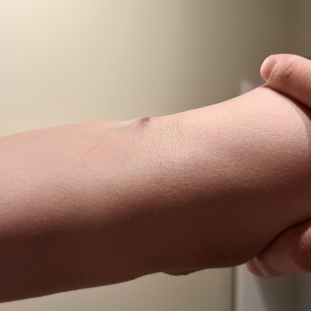 Any Lab Test Now - My bump - Laboratory Testing Near Me - Redmond, Washington Any Lab Test Now - My bump - Laboratory Testing Near Me - Redmond, Washington