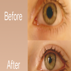 Medical Aesthetics Of New Jersey - Permanent Make-Up & Eyeliner