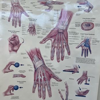 Midwest Hand Surgery - Hand chart - Surgeons Near Me - Palos Heights, Illinois Midwest Hand Surgery - Hand chart - Surgeons Near Me - Palos Heights, Illinois