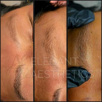 Clinical Care 365 - PMU Brows - Weight Loss Centers Near Me - Lone Tree, Colorado Clinical Care 365 - PMU Brows - Weight Loss Centers Near Me - Lone Tree, Colorado