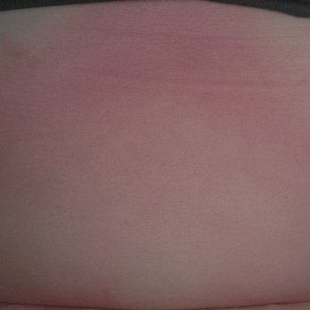Planet Fitness - I got burned on the tanning because the employee didn't do it right - Gyms Near Me - Downey, California