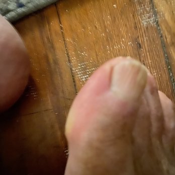 Bleu Nails & Spa - Infected right toenail - Skin Care Near Me - West Hollywood, California