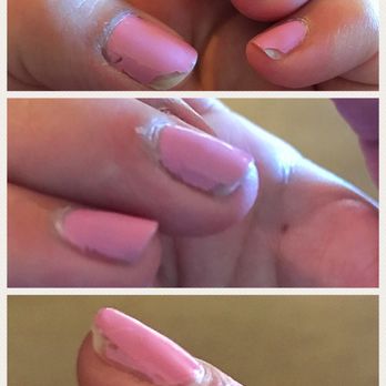 BC Nails - This is what my nails looked like 24 hours after my manicure! So beyond disappointed - Nail Salons Near Me - Salinas, California BC Nails - This is what my nails looked like 24 hours after my manicure! So beyond disappointed - Nail Salons Near Me - Salinas, California