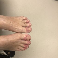 Top Ten Nails - My poor feet!