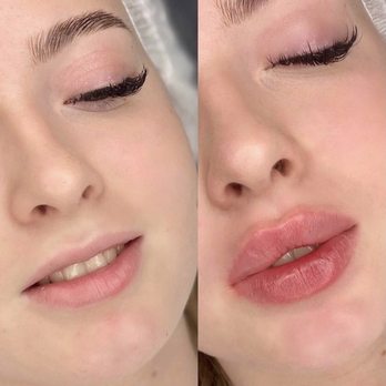 Lips By Nataly - Russian lips with keyhole - Skin Care Near Me - New York, New York Lips By Nataly - Russian lips with keyhole - Skin Care Near Me - New York, New York