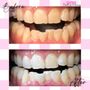Photo of Shine Teeth Whitening